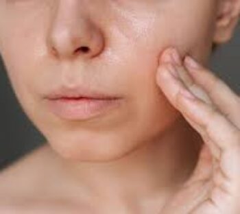 Güneş kremi yağlı ciltleri sivilcelendirir mi?